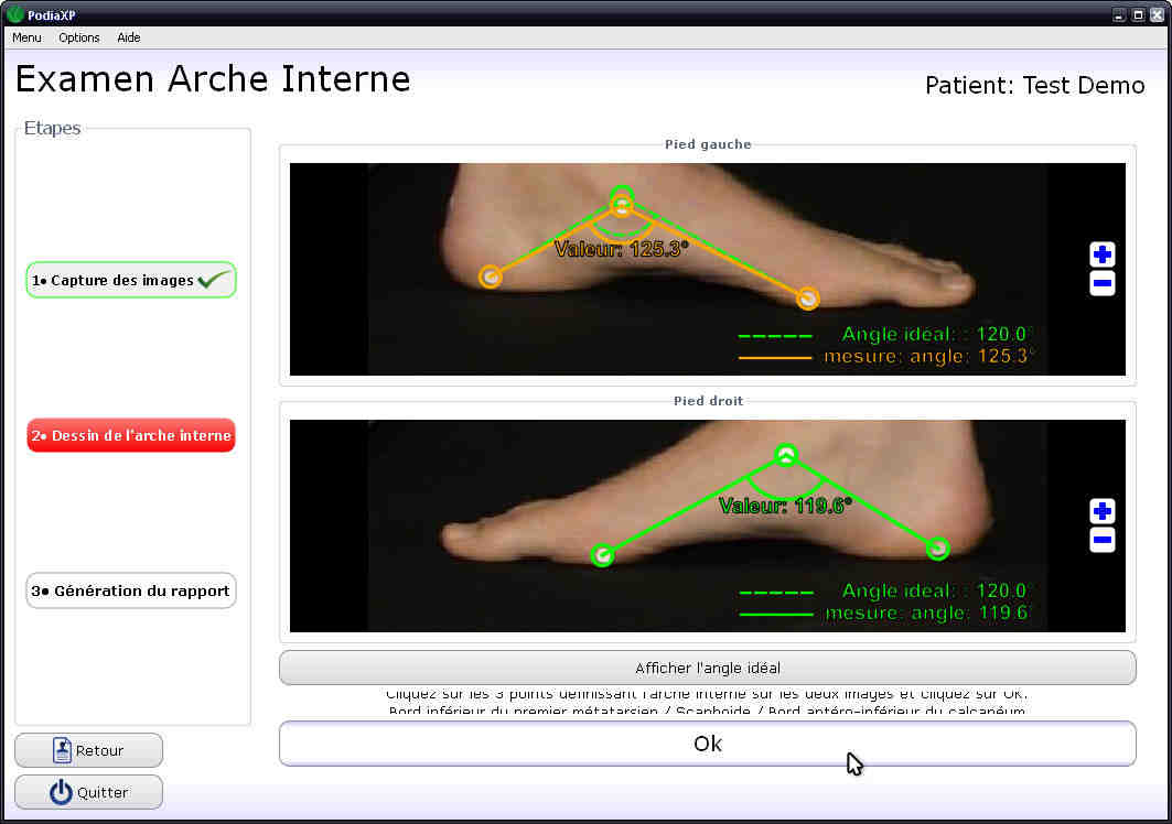 internal, arch, photo, detection